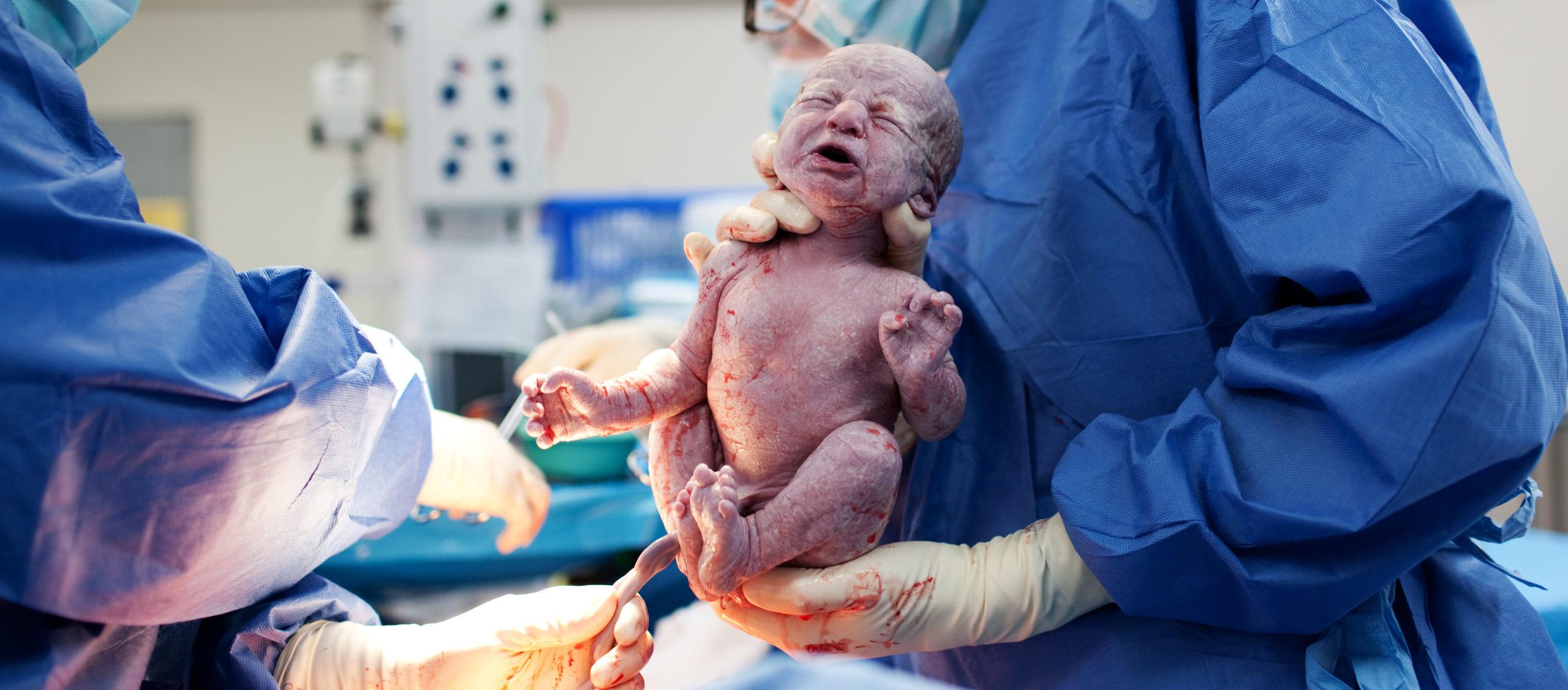 Baby being born via C-Section
