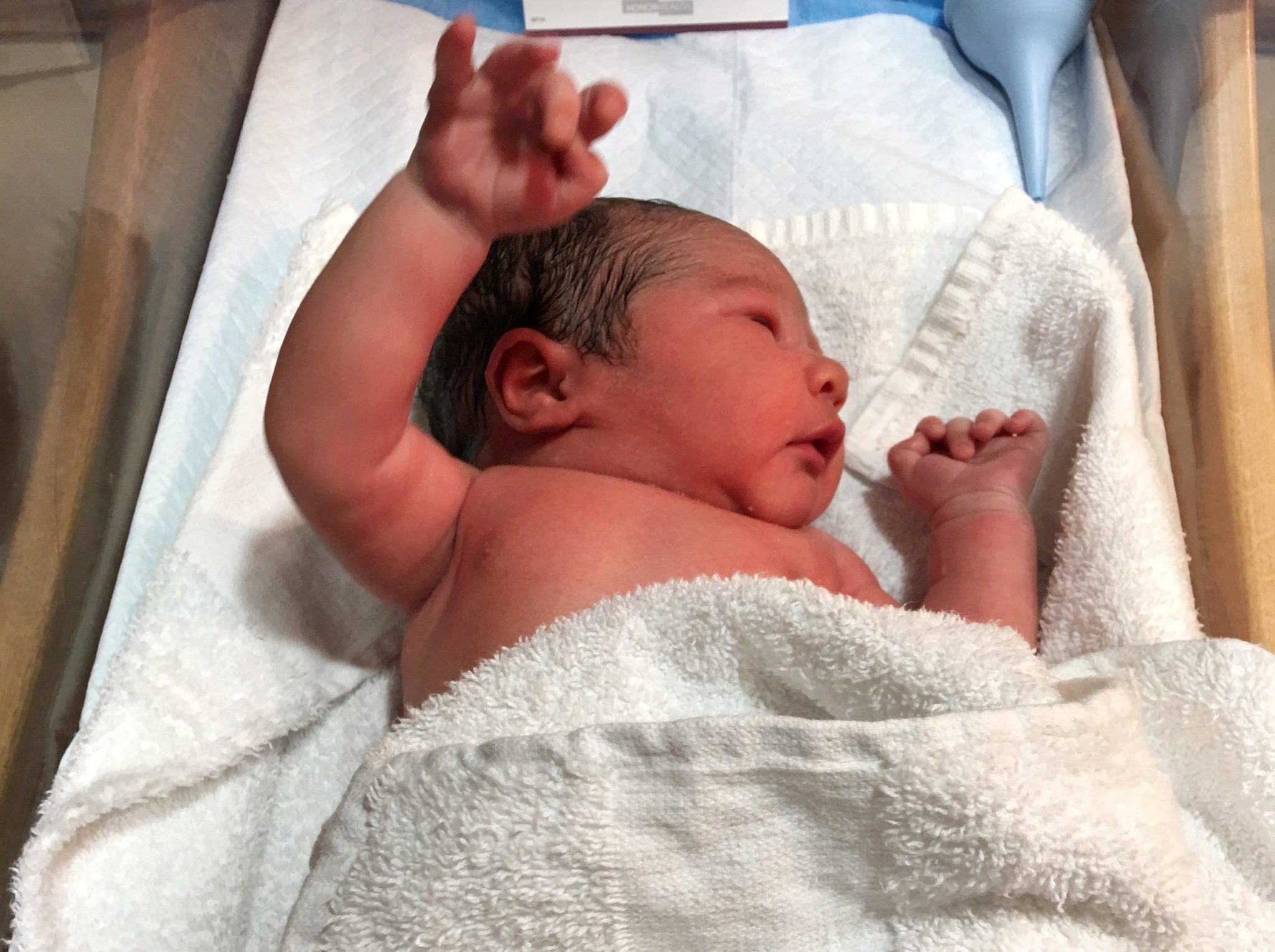 The Difference Between An Emergency CSection And Scheduled CSection